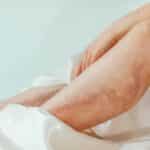 Woman's legs with varicose veins wrapped in a luxurious satin